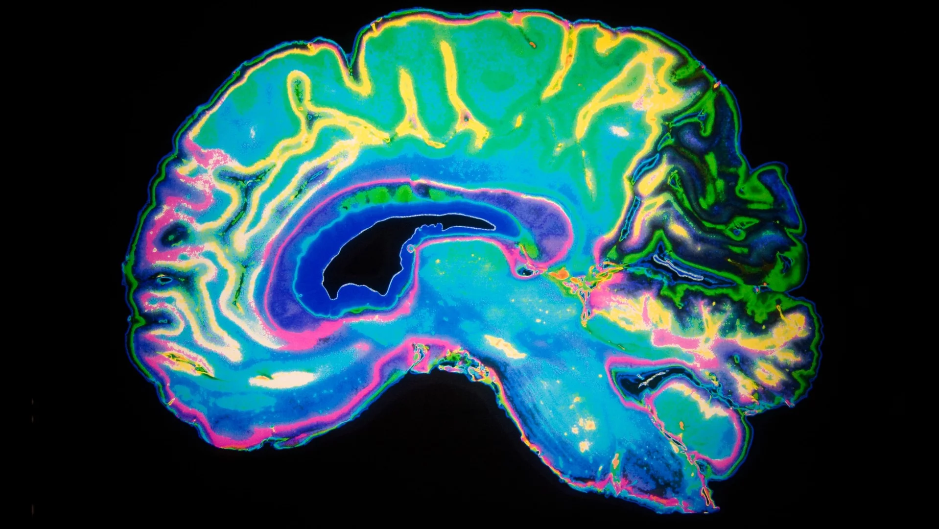 Salk Institute scientists have identified how a promising Alzheimer's drug works on the molecular level
