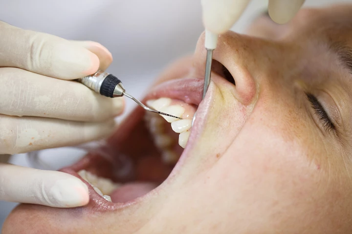 Traditional periodontal probes (pictured) are invasive and often painful