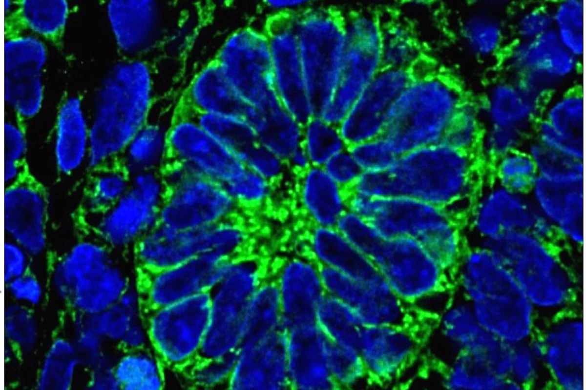 Grown in a lab from stem cells, the kidney cells developed to display organ functions after implantation into a mouse model