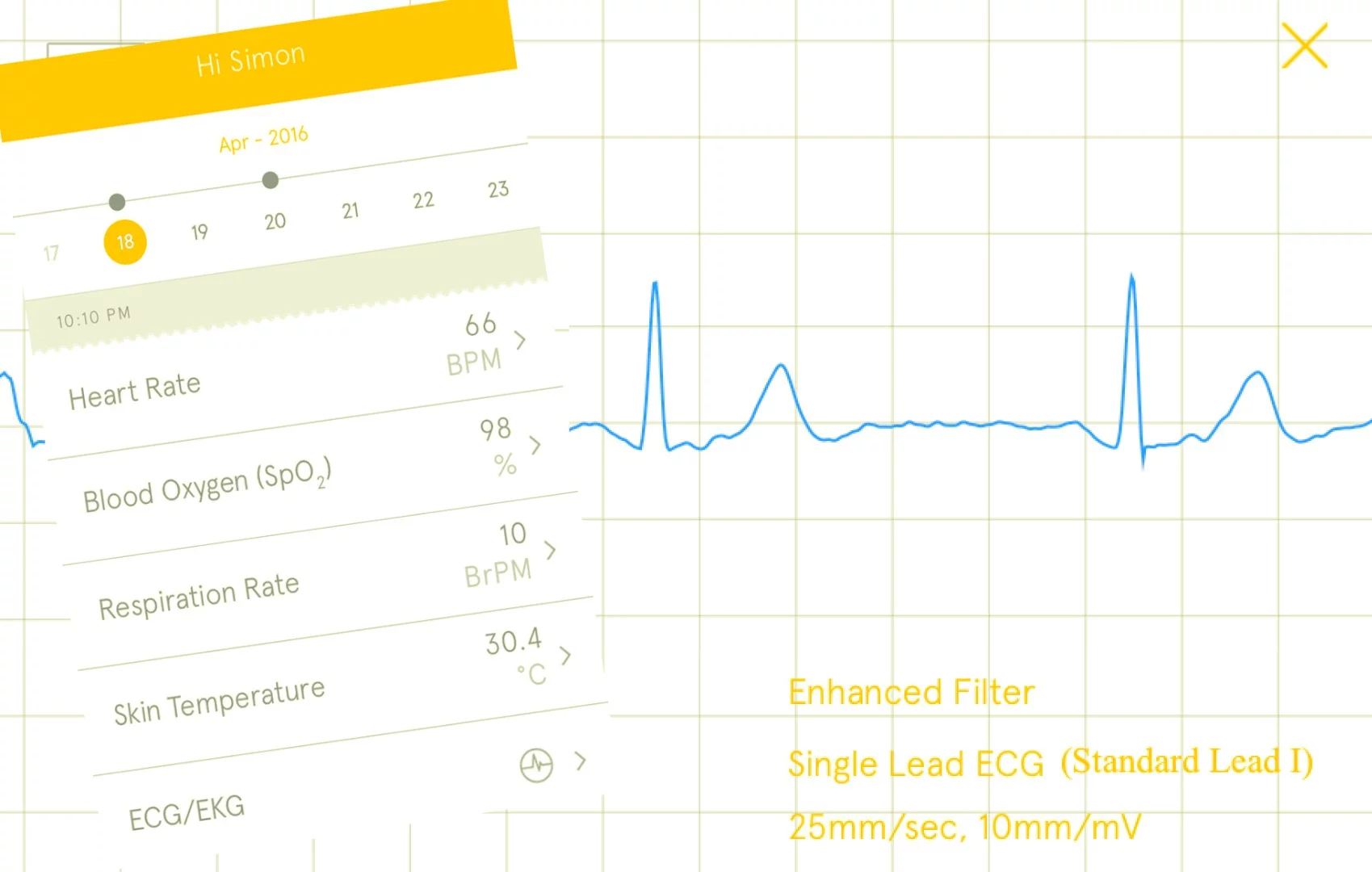 An example of the readings from the Kito+ health tracker