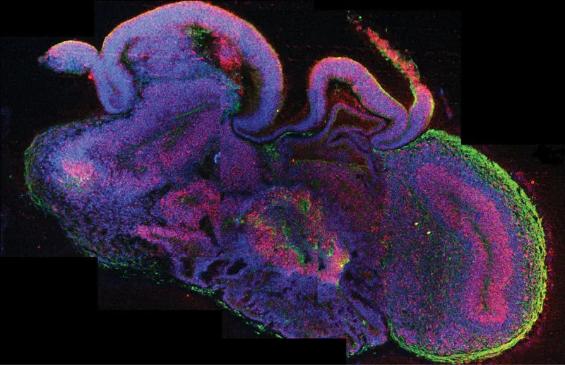 A cross section of one of the "mini brains"