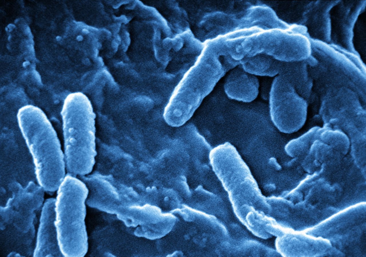 Does Uv Light Kill Bacteria On Skin | Decoratingspecial.com