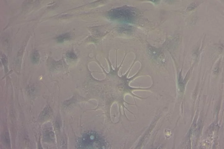 A close-up of the process of cellular senescence in human cells, a key mechanism underlying aging