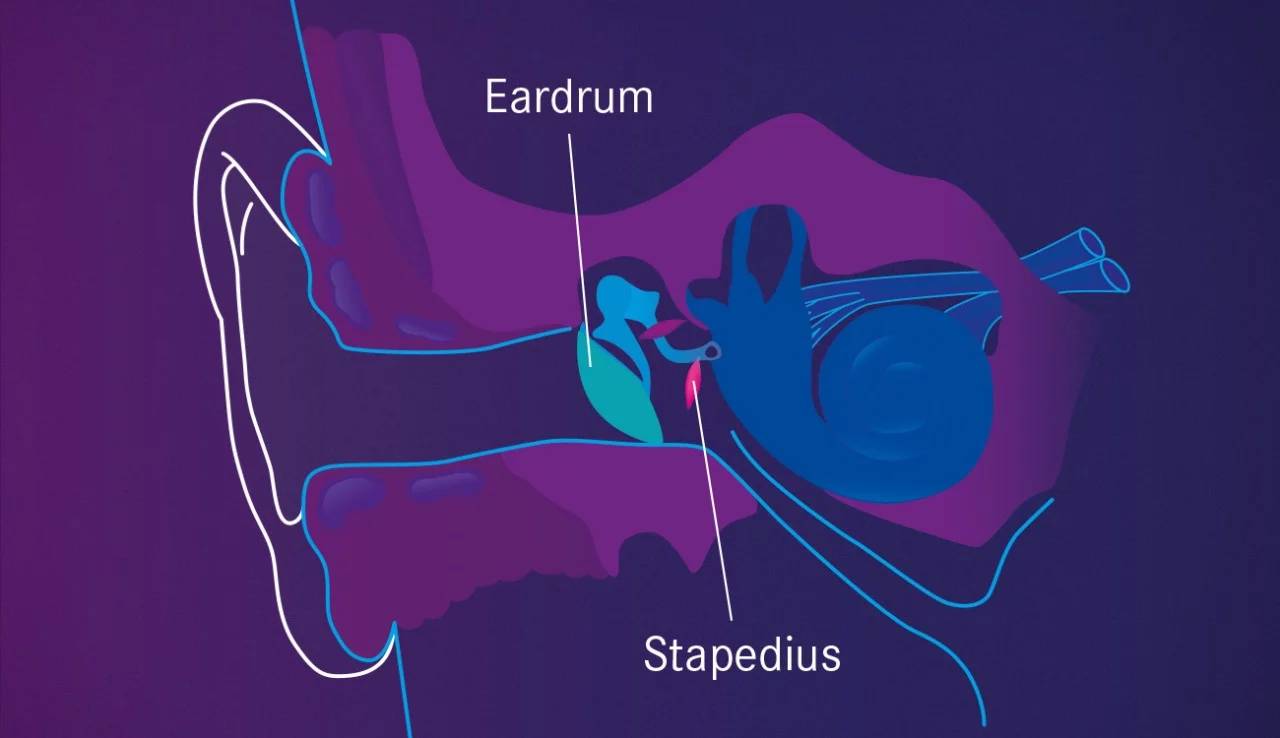 Mercedes-Benz Pre-Safe Sound: 80 decibels of pink noise activates the acoustic reflex, which flexes the stapedius muscle and helps prevent hearing damage