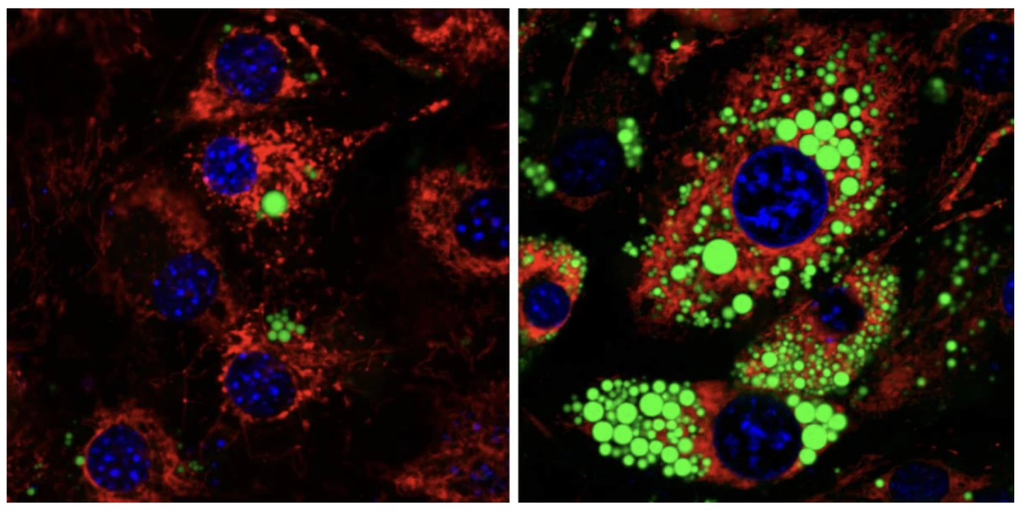 Fat cells lacking Mitch (left) have fewer fat drops (green) than regular fat cells (right)