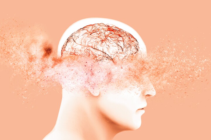 Giving a small dose of hydrocortisone to participants soon after a traumatic event could help them forget intrusive memories faster