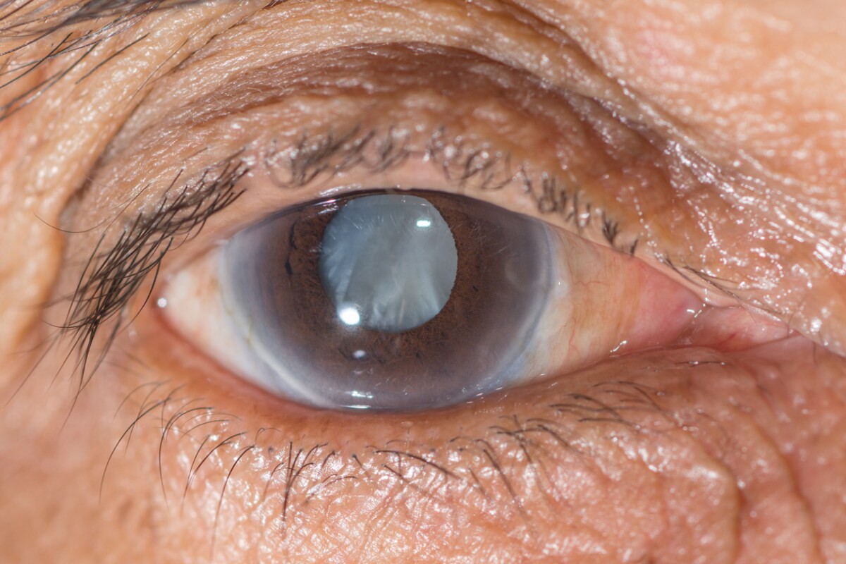 Ineye sensor to keep a watch on changes in intraocular pressure