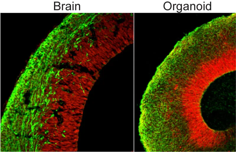 Comparison of one of the mini brains (right) to the developing brain of a mouse (left)