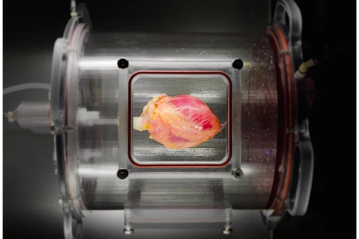 A partially recellularized human whole-heart cardiac scaffold, reseeded with human cardiomyocytes derived from induced pluripotent stem cells, being cultured in a bioreactor