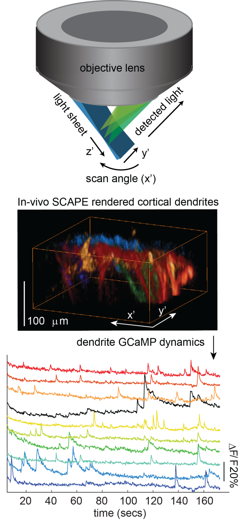 The new imaging technique that permits large-scale detection of neuronal firing in three-dimensional brain tissue (Photo: CUMC)