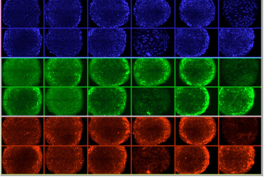 MIT researchers develop a better way to grow stem cells