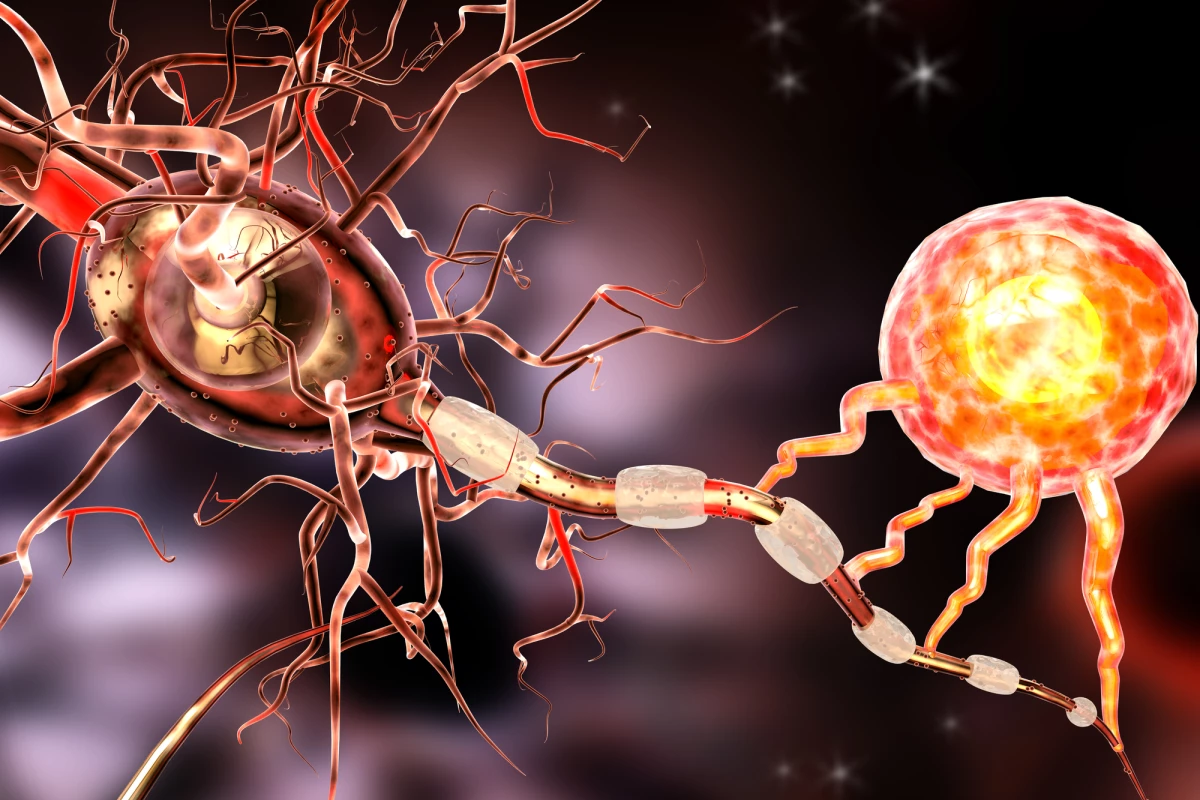 In multiple sclerosis, the body's own immune system attacks the myelin sheaths that protect nerves