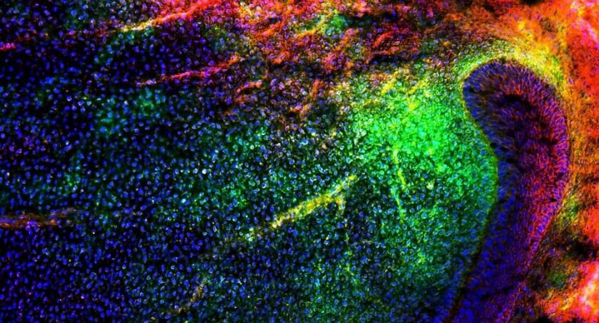 Mesenchymal stem cells (green) migrating into the tooth