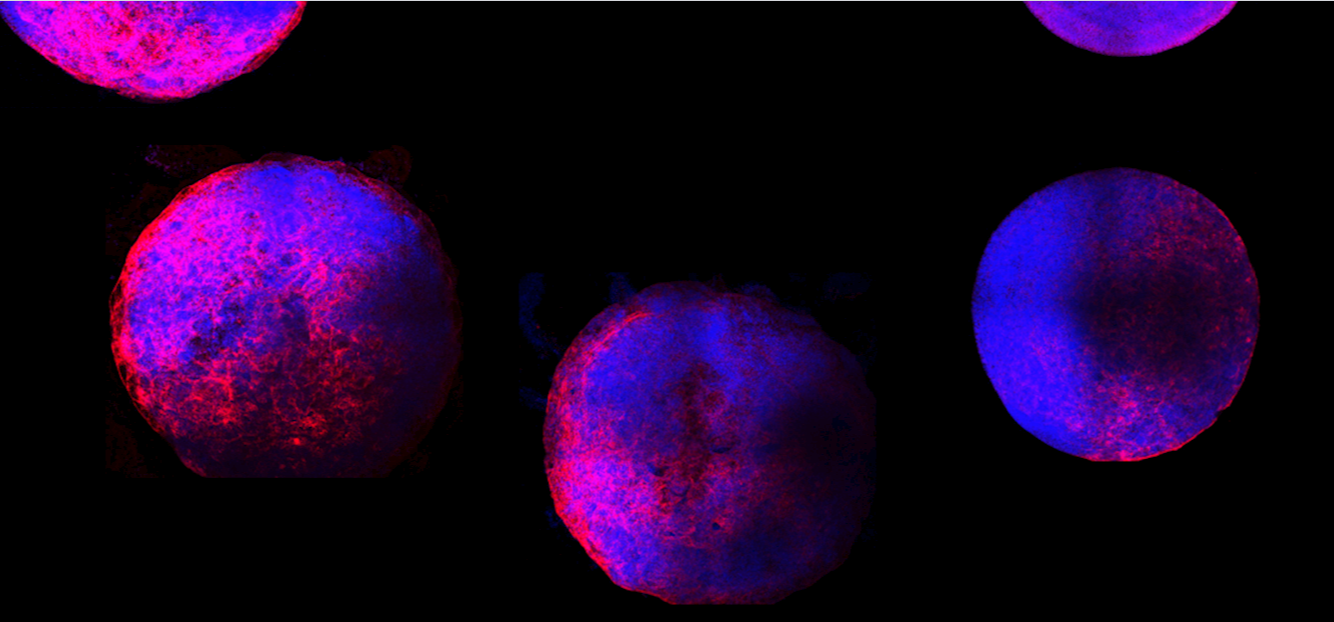 Researchers have grown new mini human hearts from stem cells in the lab