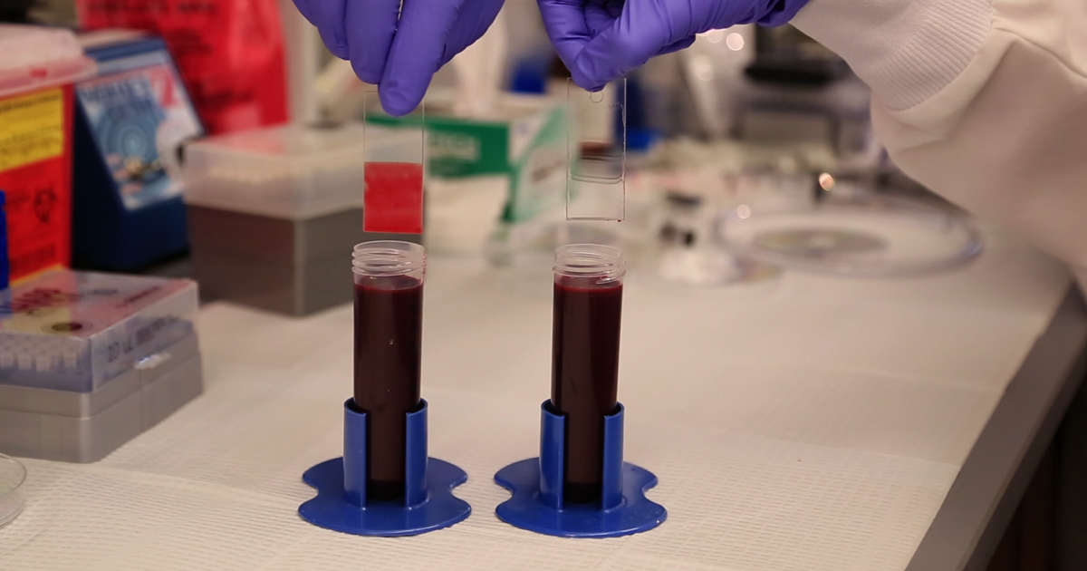 Surface coating for medical devices prevents blood clotting and ...