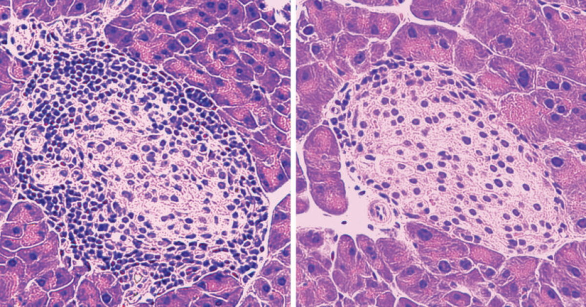 Image showcasing Type 1 diabetes prevented in mice by immune-cell-regulating peptide
