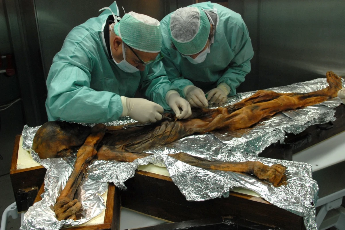 It may look like an alien autopsy, but here researchers examine the stomach contents of the 5,300-year old Iceman, Ötzi