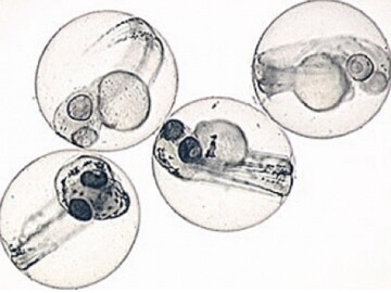 Zebrafish larvae, used in human medical research (Photo: MIT)