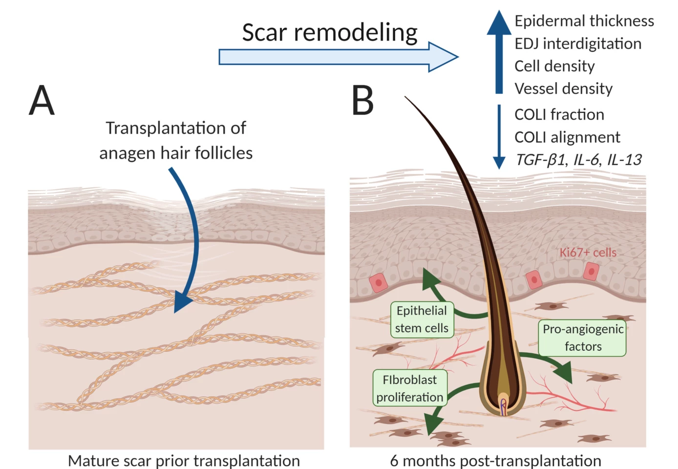 The treated scars harbored new cells and blood vessels, restored healthy collagen patterns, and even expressed genes found in healthy unscarred skin