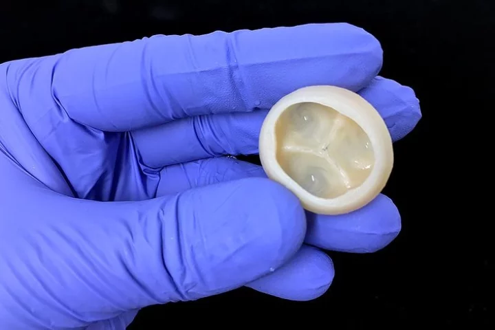 A 3D-printed heart valve produced by Carnegie Mellon University researchers