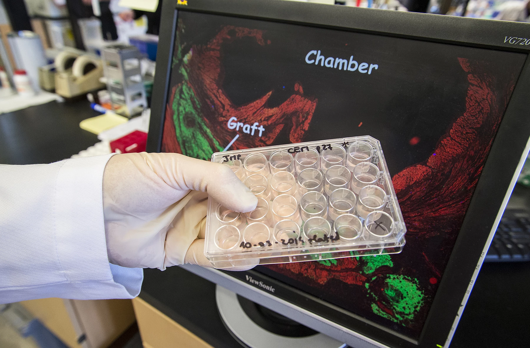 In testing the approach, the researchers anesthetized pigtail macaques and induced controlled myocardial infarctions lasting for 90 minutes apiece