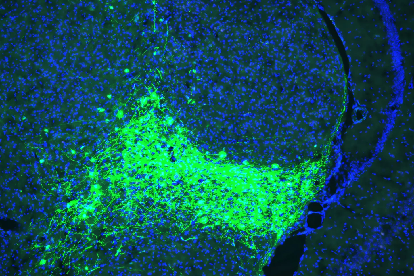 CGRP-expressing neurons (green) in the parvocellular subparafascicular nucleus (SPFp) of the thalamus