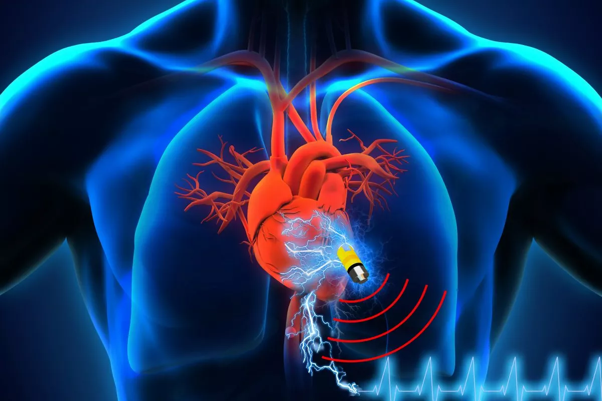 A team of researchers has developed a biofriendly supercapacitor that could allow for battery-free, lifelong implantable medical devices