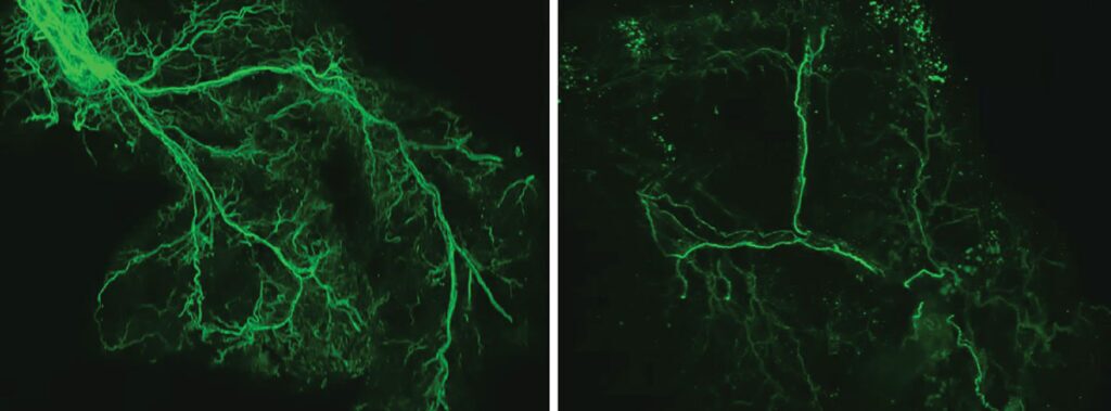 Left: A dense network of neurons between the brain and fat tissue in young mice. Right: That network becomes more sparse during the course of natural aging