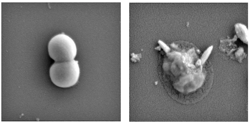 Golden Staph bacteria (left), and the aftermath of exposure to the liquid metal nanoparticles (right)
