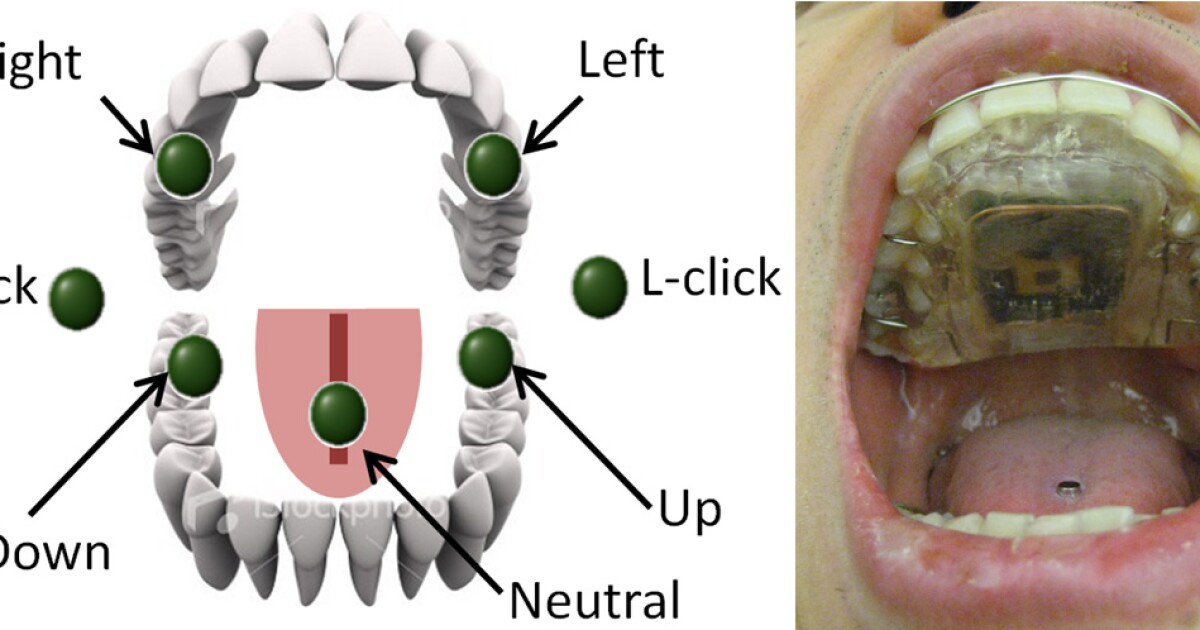 New tech allows quadriplegics to discreetly control wheelchairs using