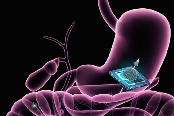 The ATOMS chip can ping its location in the body in response to an MRI scan, allowing doctors to one day keep track of medical nanobots inside patients