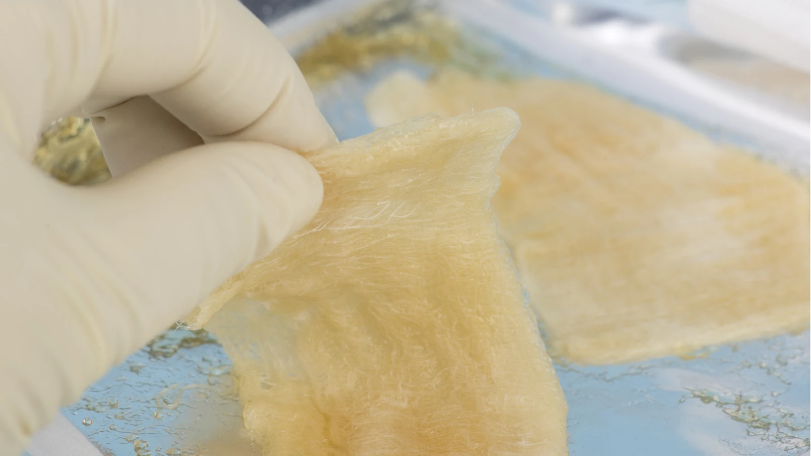 Bioengineers have developed a new protein-based gel (not pictured) that mimics many of the properties of elastic tissue when exposed to light
