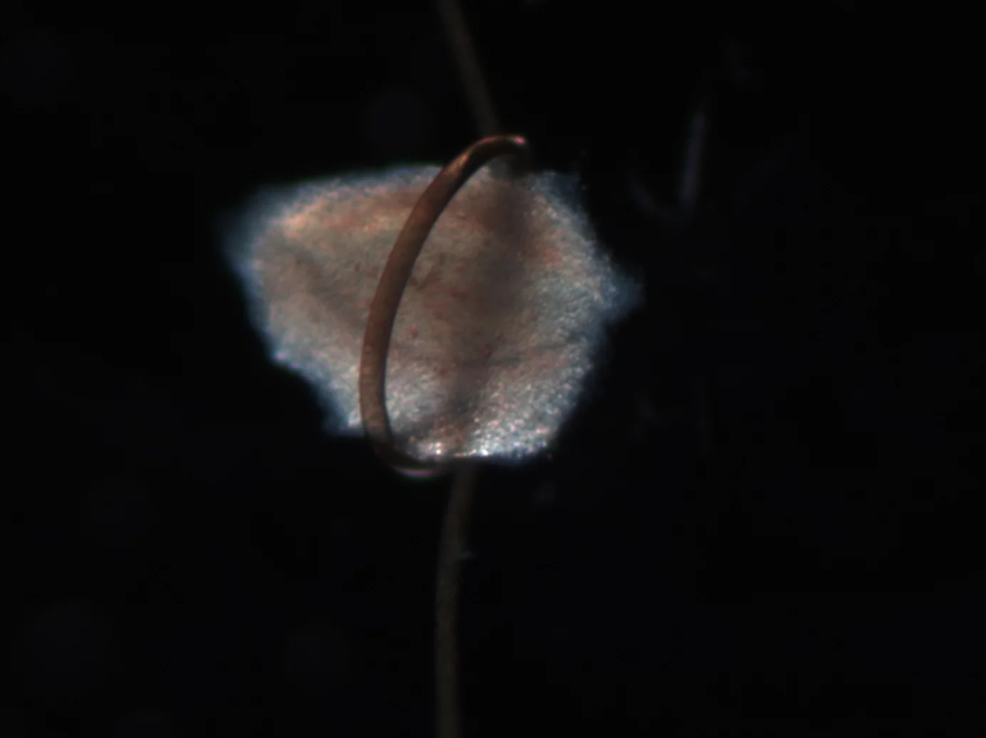 A tooth germ held in a nylon noose