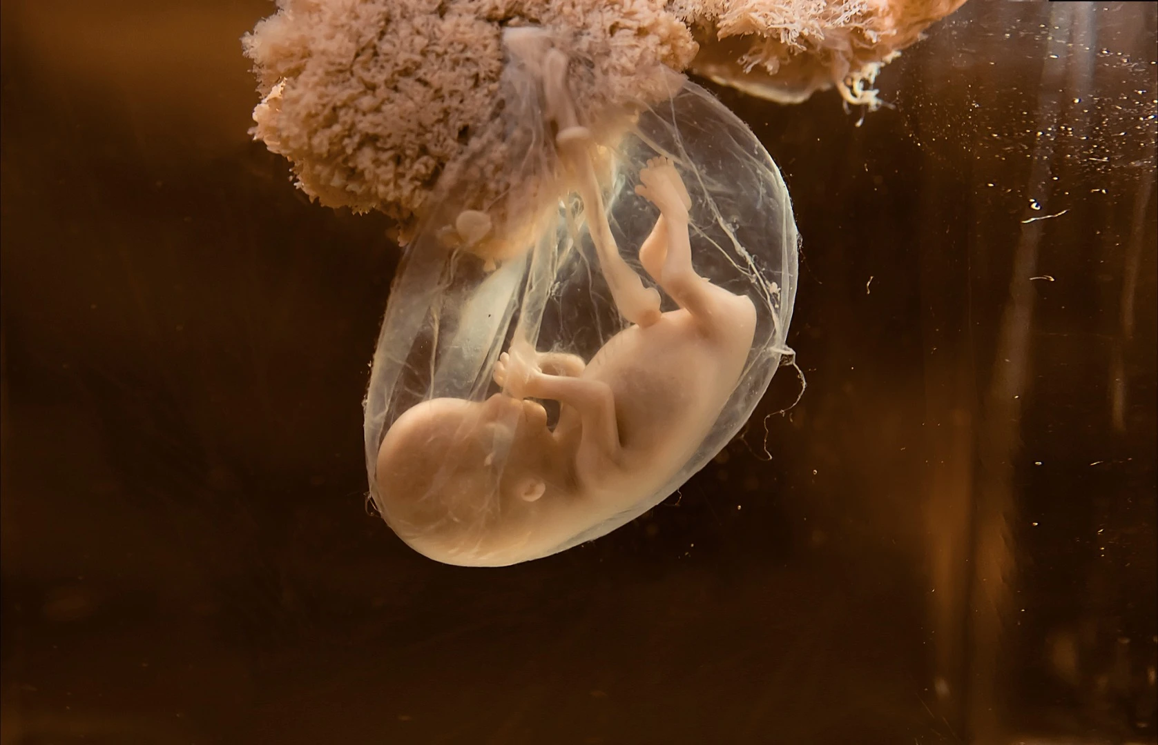 Are c-section births shaping human evolution?