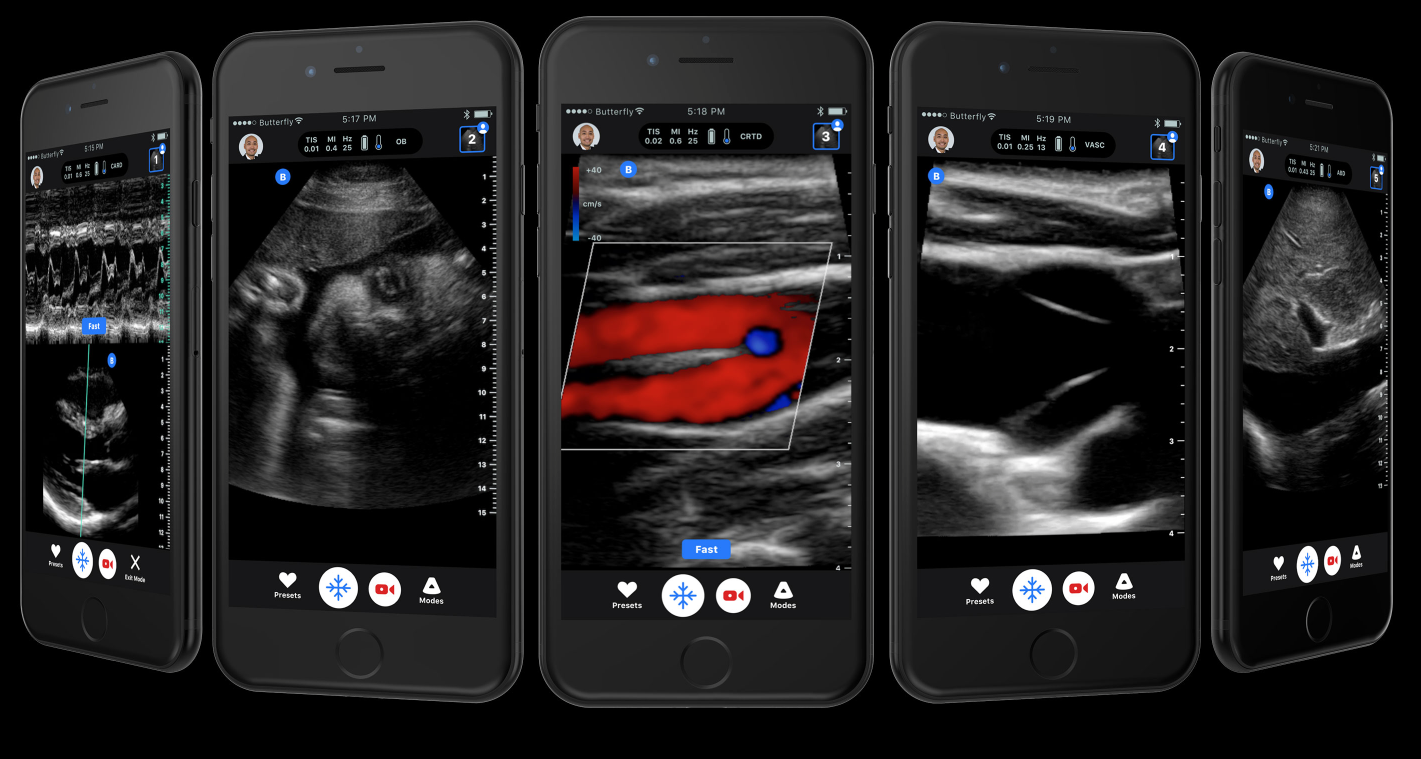 Pocket Sized Affordably Priced Ultrasound Connects To An Iphone Our handheld ultrasound device is easy to use, works with iphone and android and fits in your pocket. affordably priced ultrasound connects