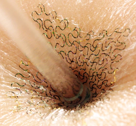 The circuits' filamentary serpentine shape allows them to bend, twist, scrunch and stretch while maintaining functionality (Image: John Rogers)