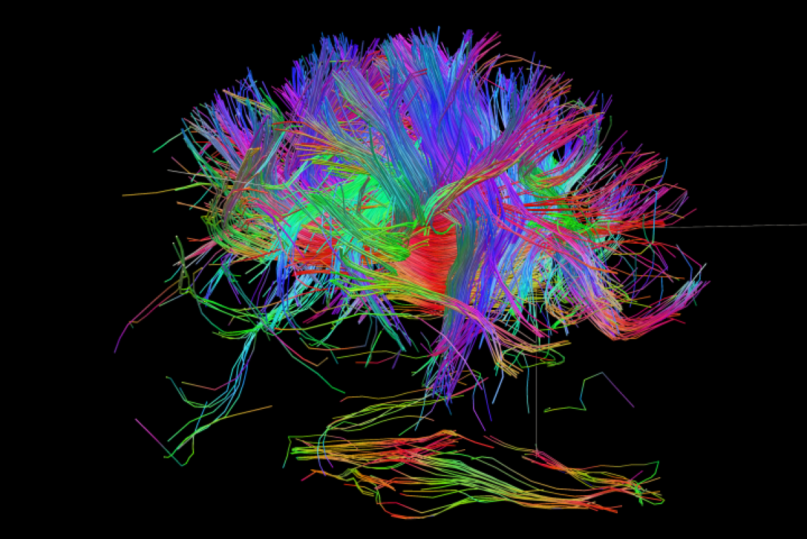 If Genes Dont Turn Off Brains Wiring >> Can We Build A Complete Wiring Diagram Of The Human Brain If Genes Dont Turn Off Brains Wiring >> Can We Build A Complete Wiring Diagram Of The Human Brain