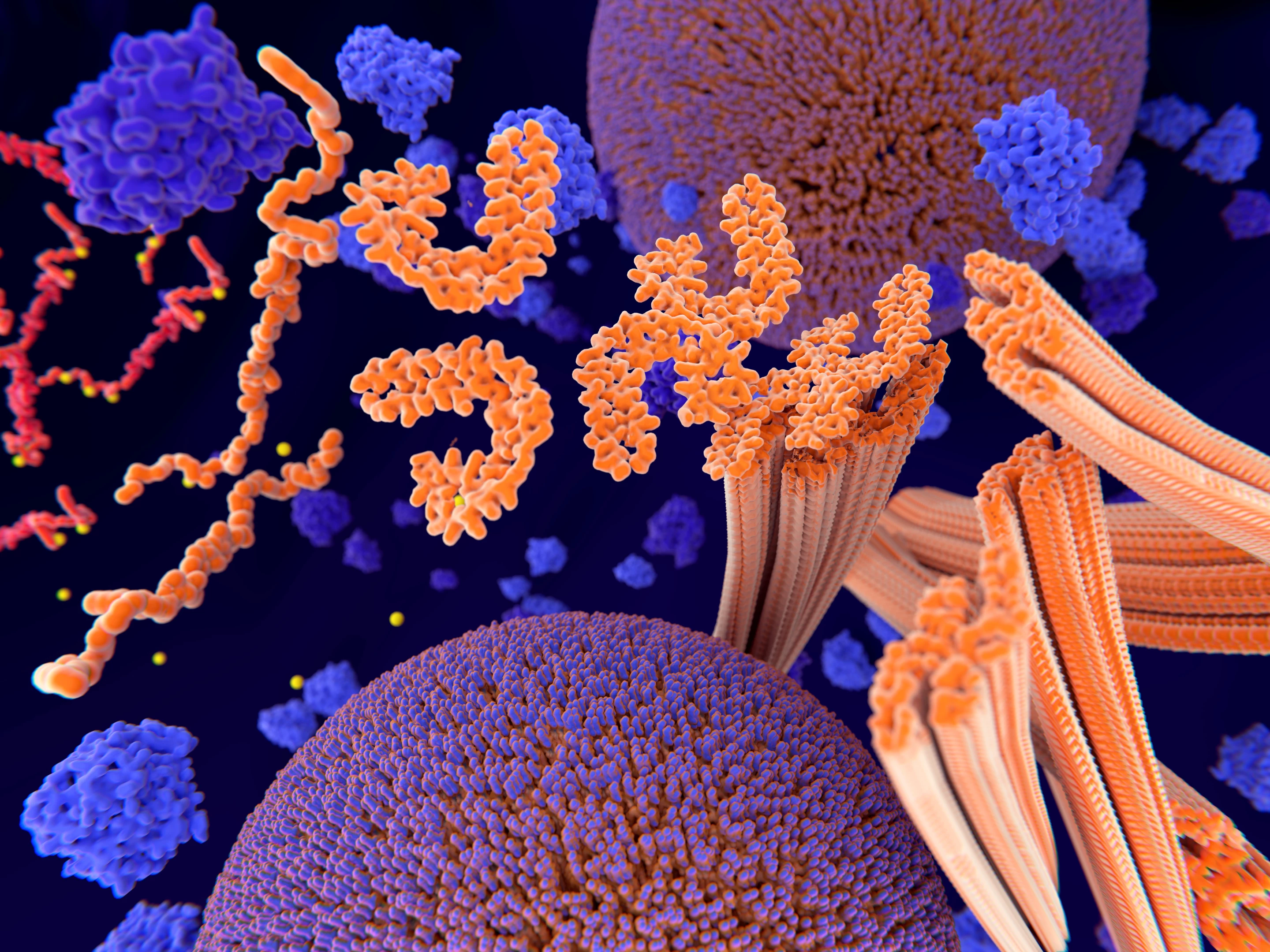An artist's impression of tau tangles taking hold in the brain, which are considered one of the drivers of Alzheimer's disease