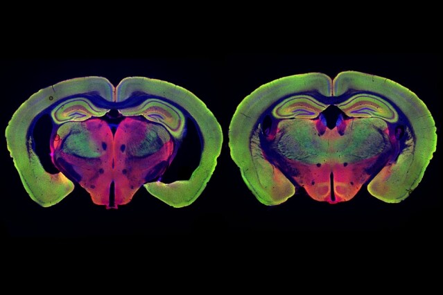 At left is the brain of a mouse genetically programmed to develop Alzheimer’s disease. At right, the brain of a mouse programmed to develop the disease, but treated with noninvasive visual stimulation, shows much less neurodegeneration