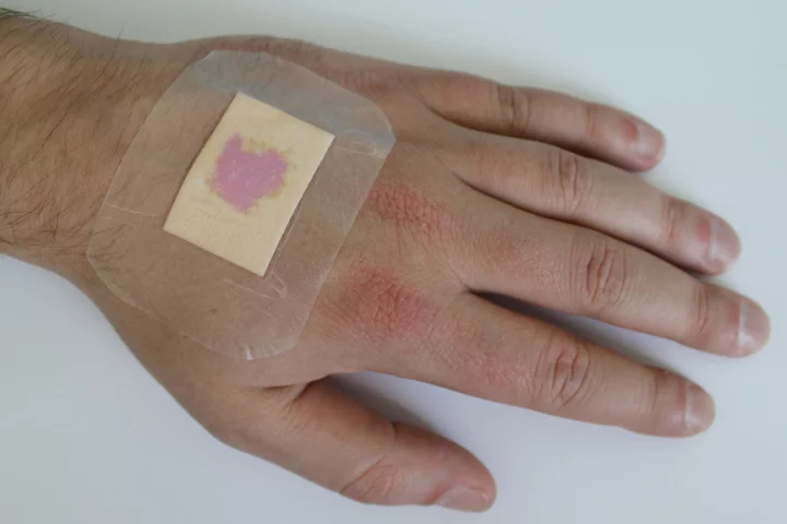 The new dressing material indicates infection by turning purple (Image: Fraunhofer EMFT)