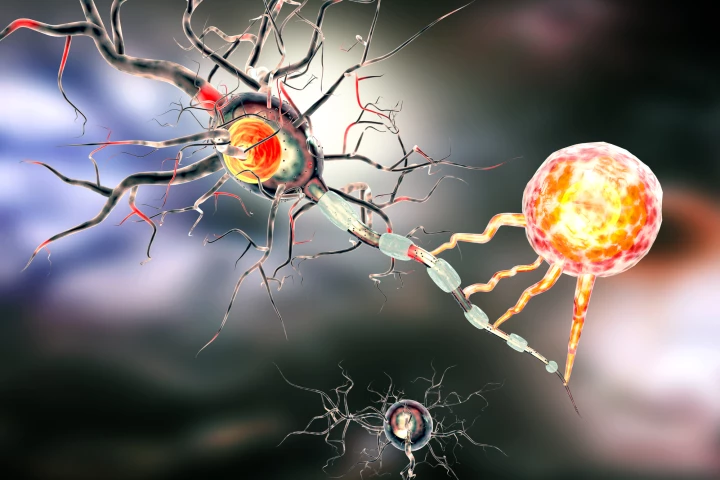 After crossing the blood-brain barrier, nanoparticles were able to deliver electrical pulses to the brain, potentially eliminating the need for brain-stimulating implant surgery
