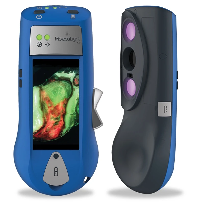 The MolecuLight i:X is currently approved for use in Canada and the European Union, but not in the US