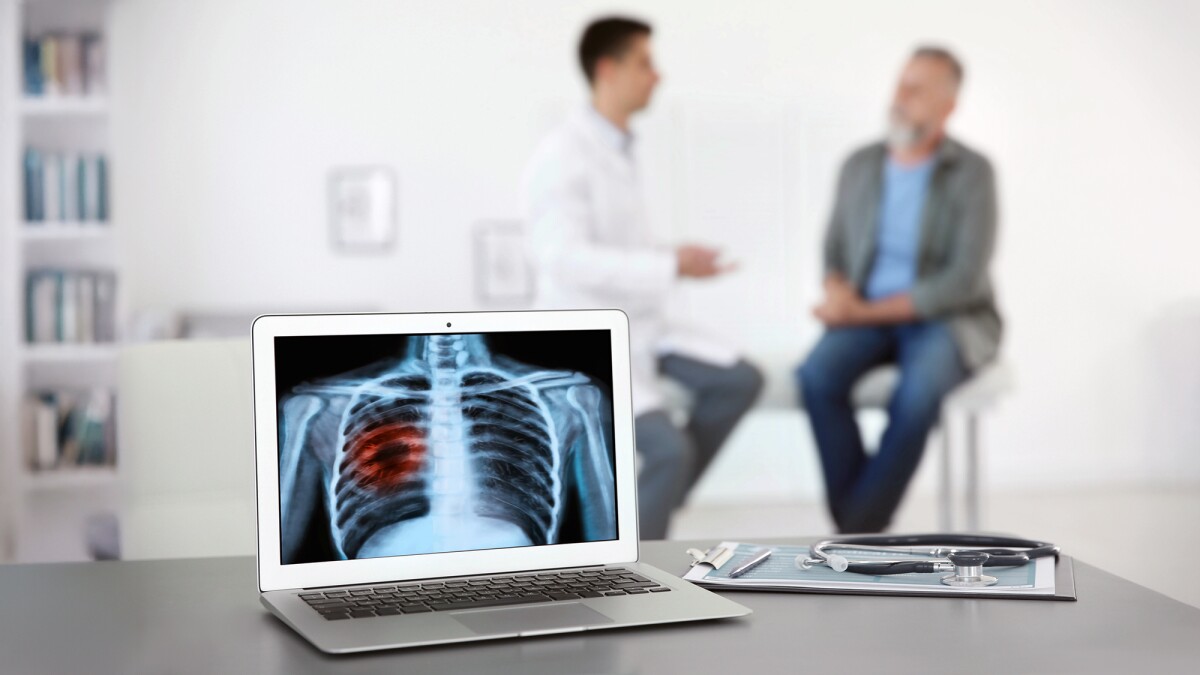 Radiation a 'strong alternative to surgery' for early-stage lung cancer