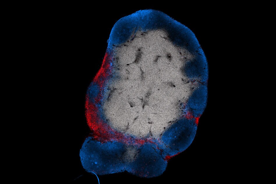 An MIT team has developed a vaccine to stimulate T cells (red) to attack solid tumors in mice