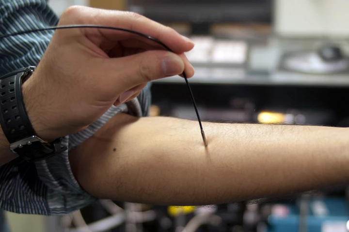 MIT researchers have devised a way to measure blood glucose levels by shining near-infrared light on the skin (Image: Patrick Gillooly)