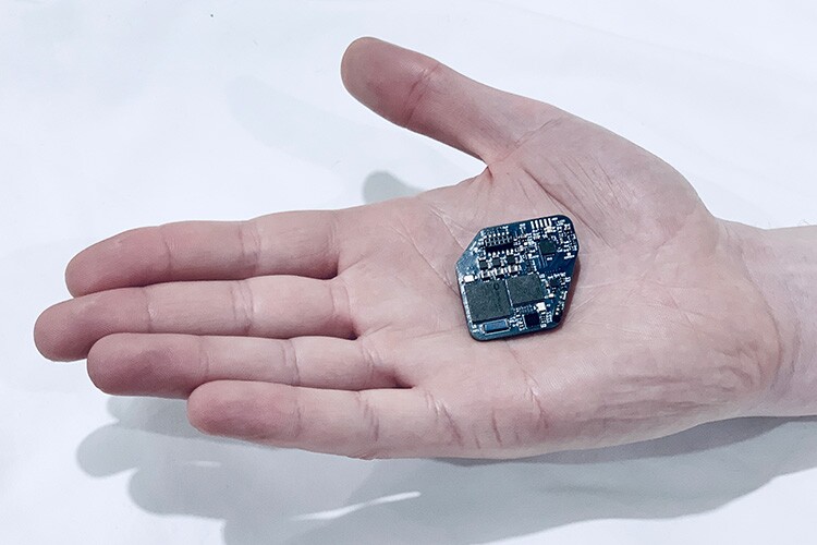 The WAND chip is designed with custom integrated circuits that can record the full signal from both subtle brain waves and strong electrical pulses delivered by the stimulator