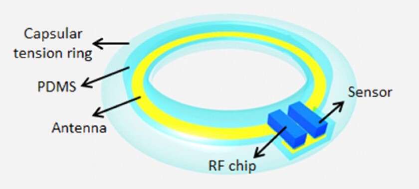 Illustration of the final device that would be placed in an artificial lens with its antenna circling the perimeter, and the sensor and radio frequency chip inside (Image: UW)