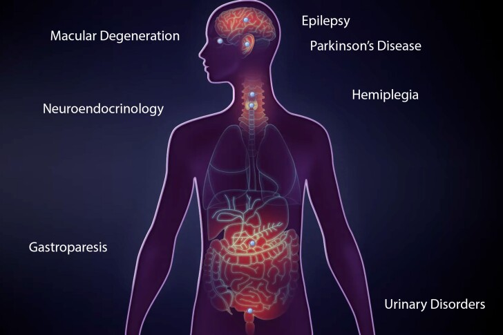 Axorus's artificial neurons could treat a range of conditions when integrated with different systems around the body