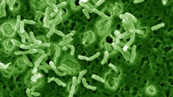 Mycobacterium vaccae