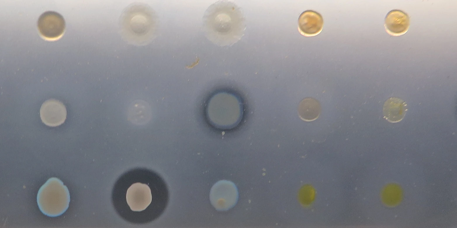 The new antibiotic shows off its skills at inhibiting bacterial growth in the samples in the middle of the middle row, and the second from the left on the bottom row